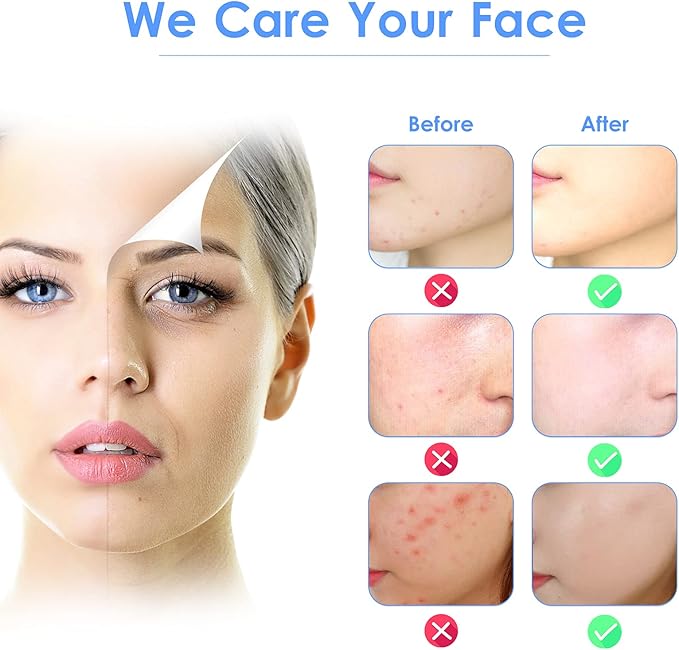 3-in-1 Ultrasonic Skin Scrubber & Deep Facial Cleanser