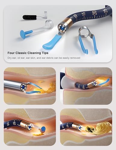 Bebird Smart Ear Cleaner