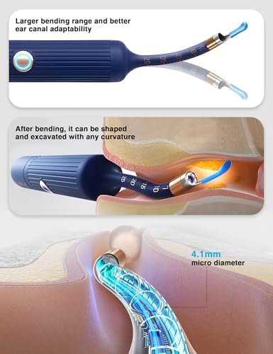 Bebird Smart Ear Cleaner