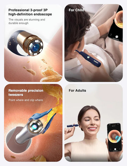Bebird Smart Ear Cleaner