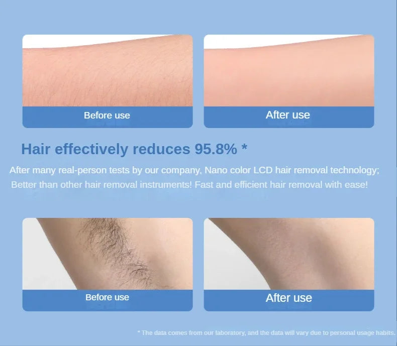Zenvéra Crystal Hair Remover – Painless Magic Hair Eraser for Smooth Skin