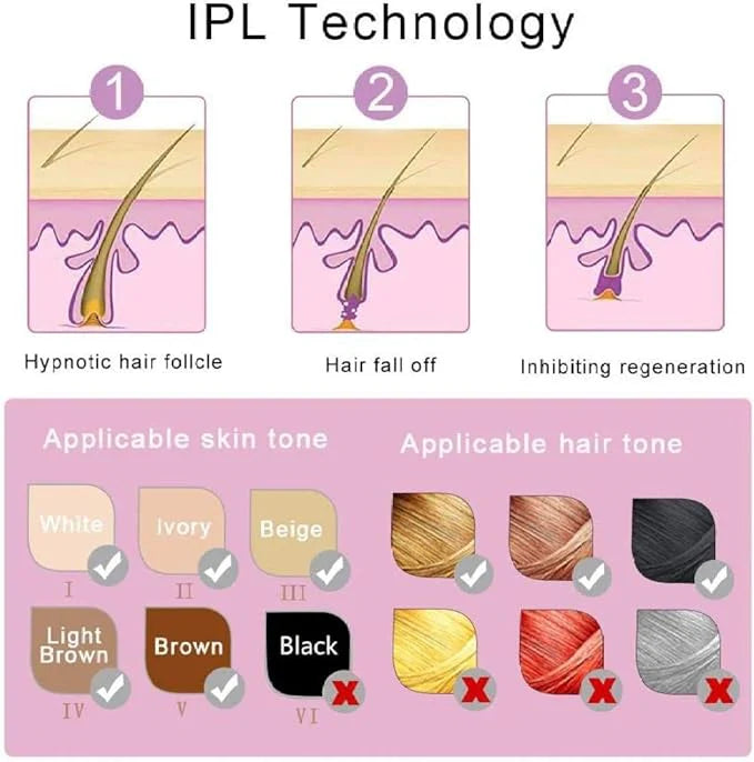 IPL Laser Hair Removal Handset (Permanent Painless Epilator)